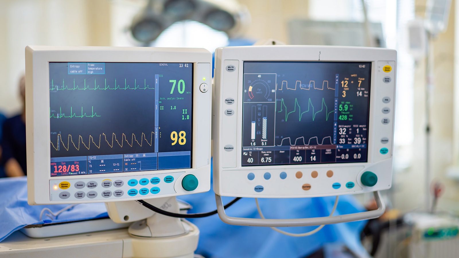 Medical equipment displays vital signs in a hospital room, capturing heart rate and blood pressure during patient care